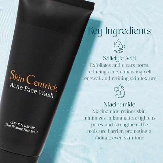 Acne Face Wash image 1